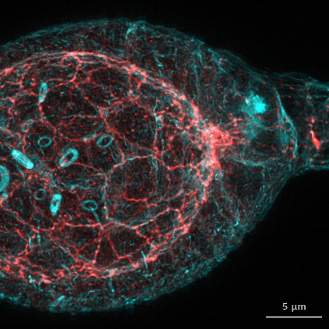 Drosophila germarium. Imagen captada con ZEISS Airyscan 2 seguida de la tecnología Joint Deconvolution.