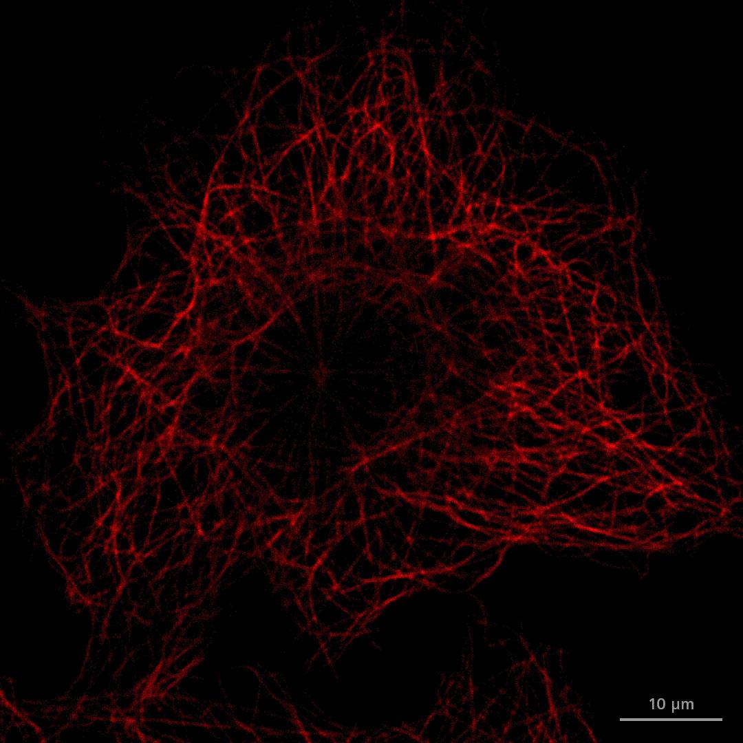 Comparaison de ZEISS LSM 980 MA-PMT et du détecteur NIR GaAsP ZEISS ; excitation au laser 639 nm à puissance de laser identique. La plage d'émission du MA-PMT est réglée sur 660 – 757 nm, et pour le détecteur NIR sur 660 – 900 nm.