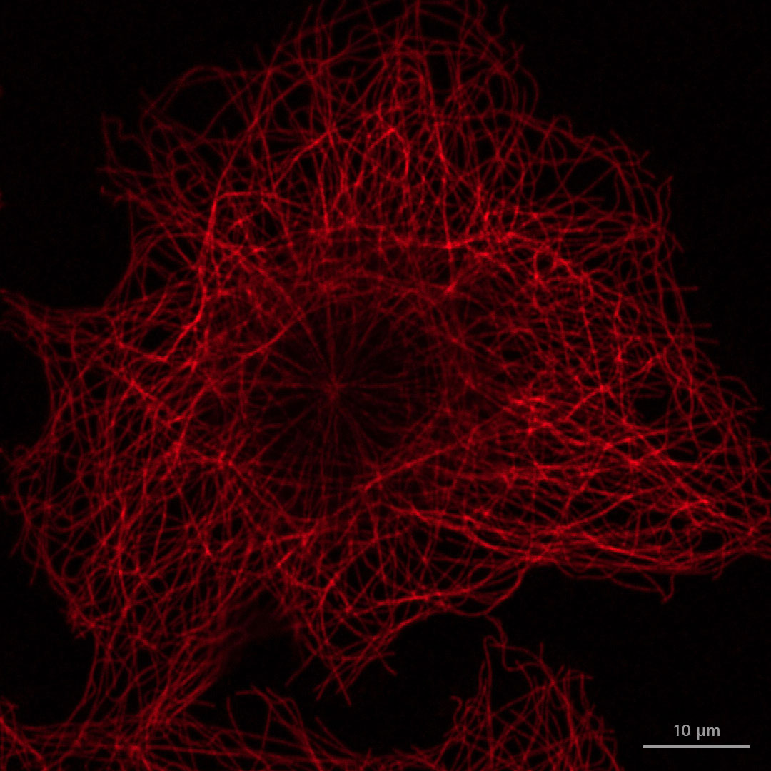 Vergleich des ZEISS LSM 980 MA-PMT und des ZEISS NIR GaAsP-Detektors; Anregung mit Laser (639 nm) mit derselben Laserleistung. Emissionsbereich für den MA-PMT: 660–757 nm; für den NIR-Detektor: 660–900 nm.