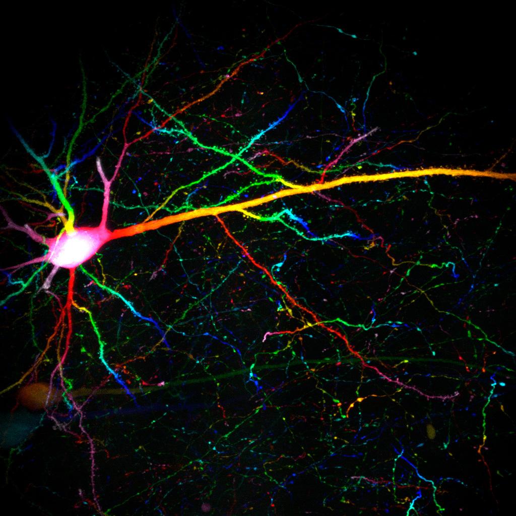 Maus-Hirnschnitt mit neuronaler zytoplasmatischer GFP-Markierung