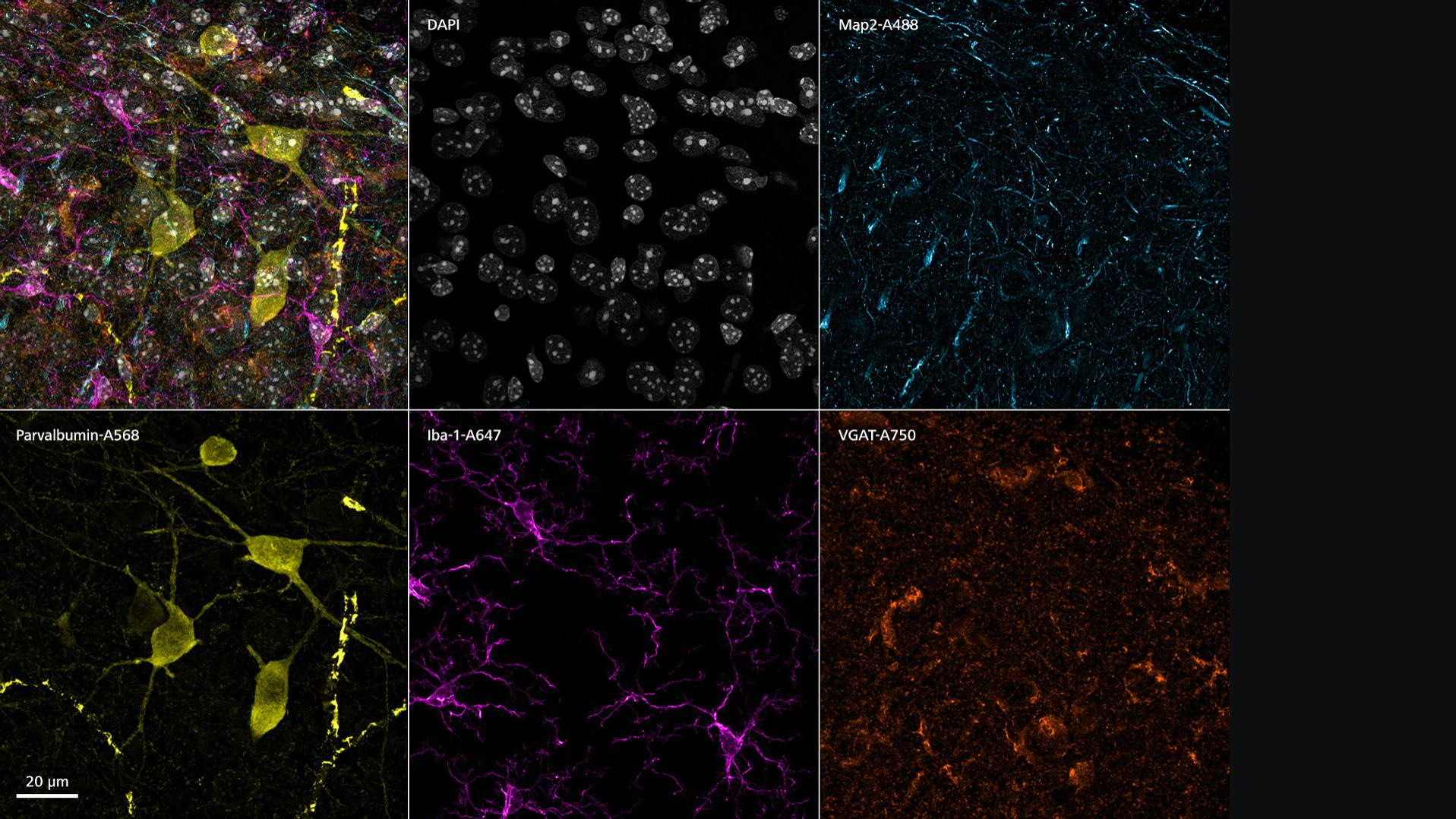 Échantillon de tranche de cerveau à 5 couleurs acquise en mode Lambda et traitée avec LSM Plus. Canaux après démixage spectral : DAPI, Map2-A488, Parvalbumin-A568, Iba-1-A647, VGAT-A750, Autofluorescence