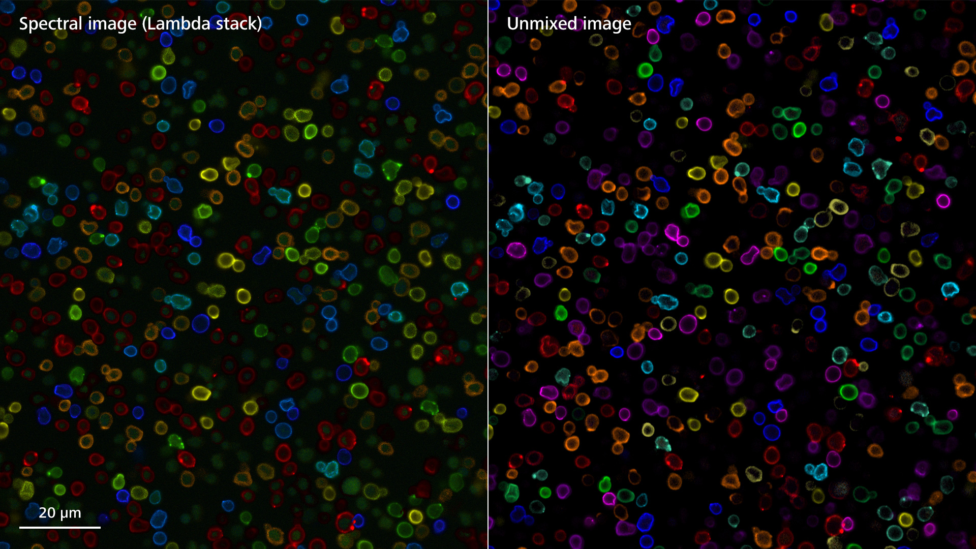 Izquierda: Imagen espectral (lambda stack) de 13 marcadores adquiridos simultáneamente, representación en color real. Derecha: imagen segregada de 13 marcadores sin autofluorescencia, procesamiento con LSM Plus.