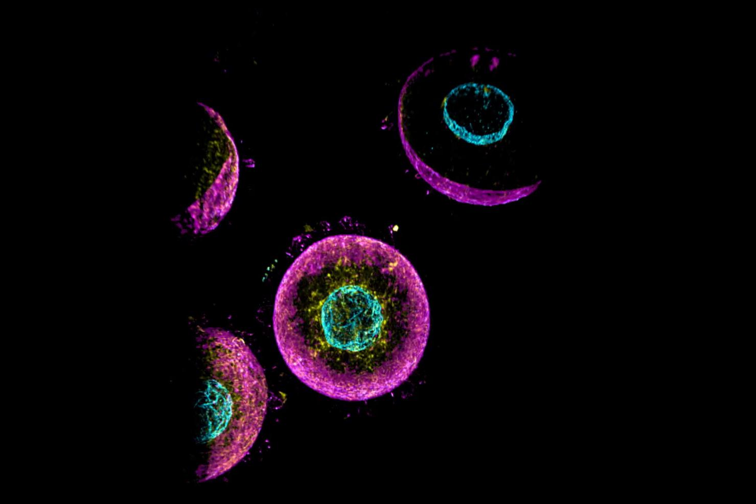 Fixed mouse germinal vesicle oocytes stained for the nuclear envelope (anti-lamin, cyan), actin (phalloidin, magenta), and microtubules (anti-tubulin, yellow). The Sinc3 100 × 1,800 lattice light sheet was used for imaging of the whole oocyte. 