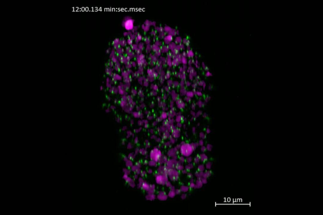 C. elegans embryo at the late bean stage (~400 min post fertilization) with ~560 nuclei marked with HIS-58::mCherry (magenta) and centrioles marked by GFP::SAS-7 (green). Cells in mitosis show condensed signal of HIS-58::mCherry and centrioles at spindle poles. Sample: courtesy of N. Kalbfuss, Göncy Lab, EPFL, Switzerland.