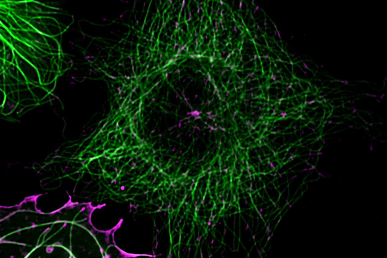 COS-7 cells transiently transfected with Calnexin-mEmerald and EB3-tdTomato