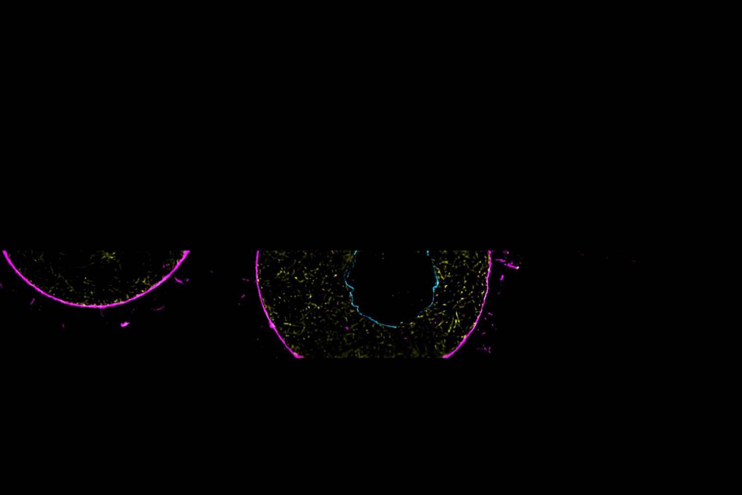 Fixed mouse germinal vesicle oocytes stained for the nuclear envelope (anti-lamin, cyan), actin (phalloidin, magenta), and microtubules (anti-tubulin, yellow). The Sinc3 15 × 650 lattice light sheet was used for high-resolution imaging of microtubule and actin structures. Follow the 3D structure of the microtubules in the movie.