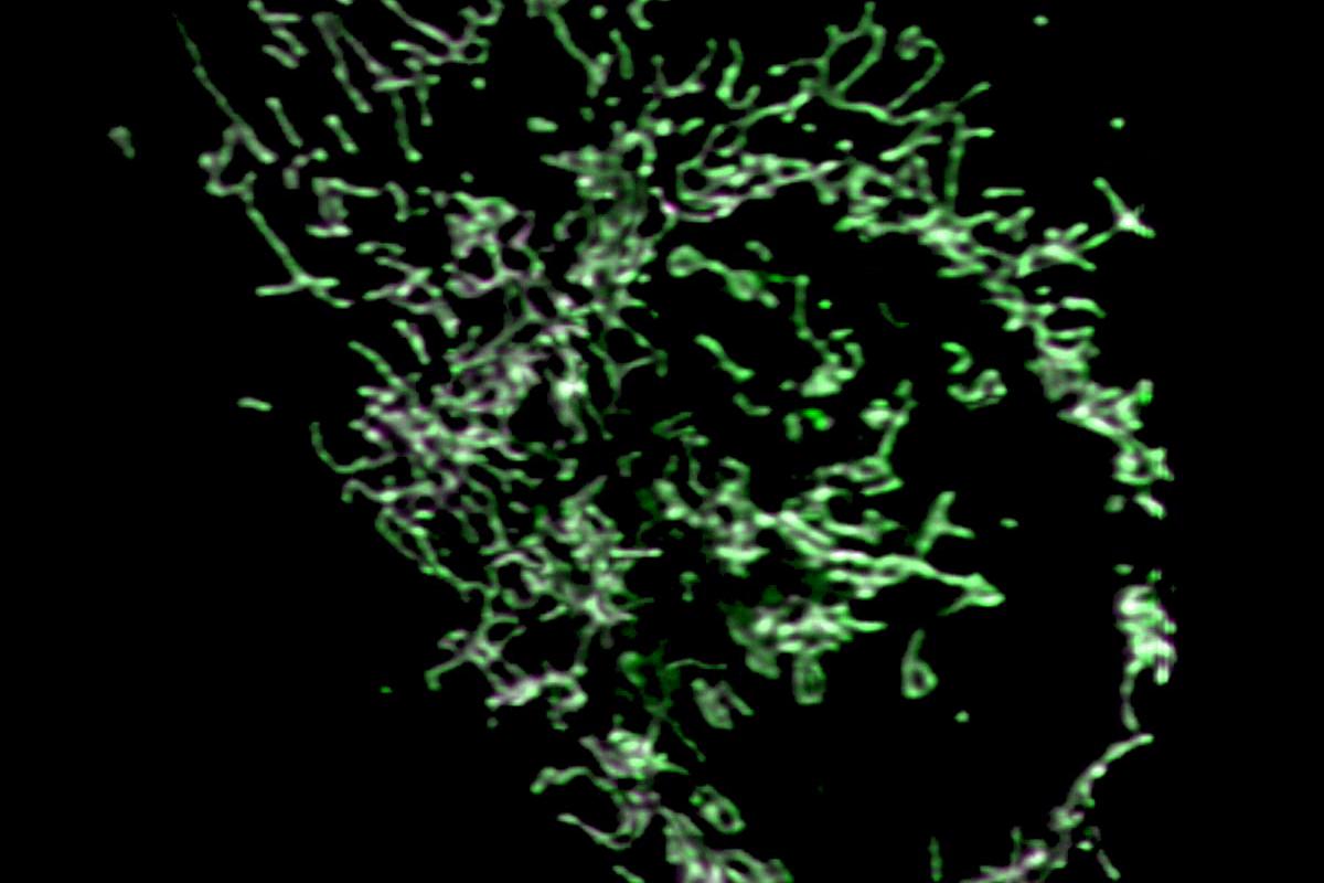 U2OS细胞用MitoTracker Green（绿色）和MitoTracker Red CMXRos（品红色）染色。