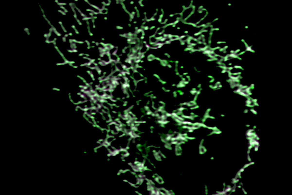 MitoTracker Green（緑）およびMitoTracker Red CMXRos（マゼンタ）で染色したU2OS細胞。