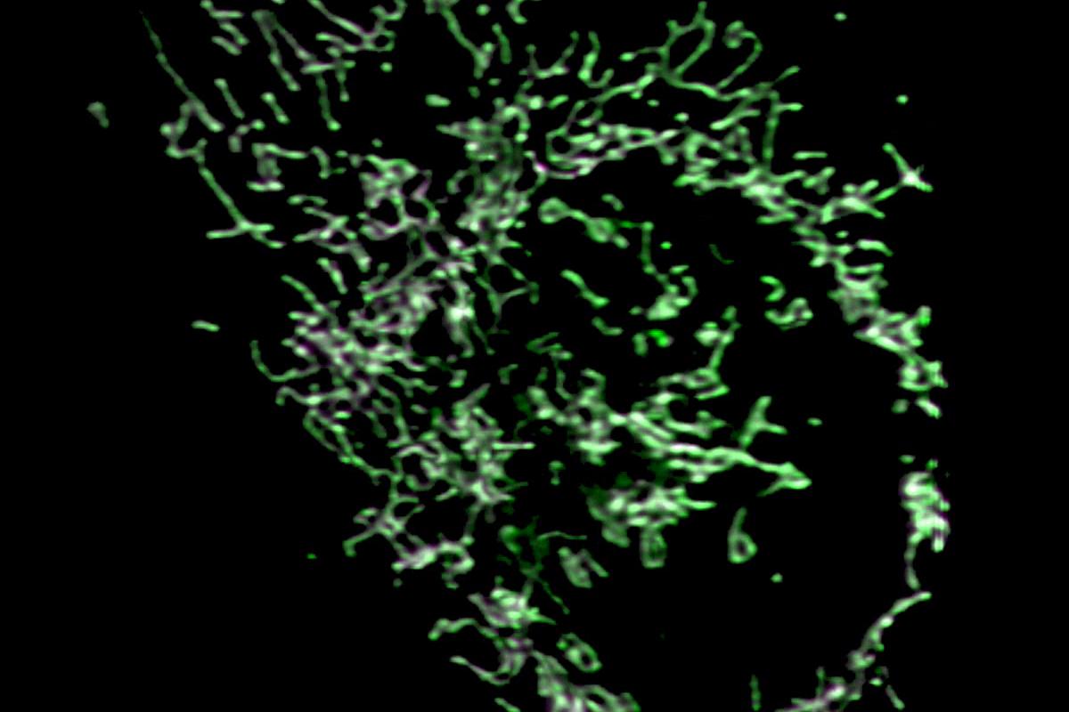 U2OS cell stained with MitoTracker Green (green) and MitoTracker Red CMXRos (magenta).