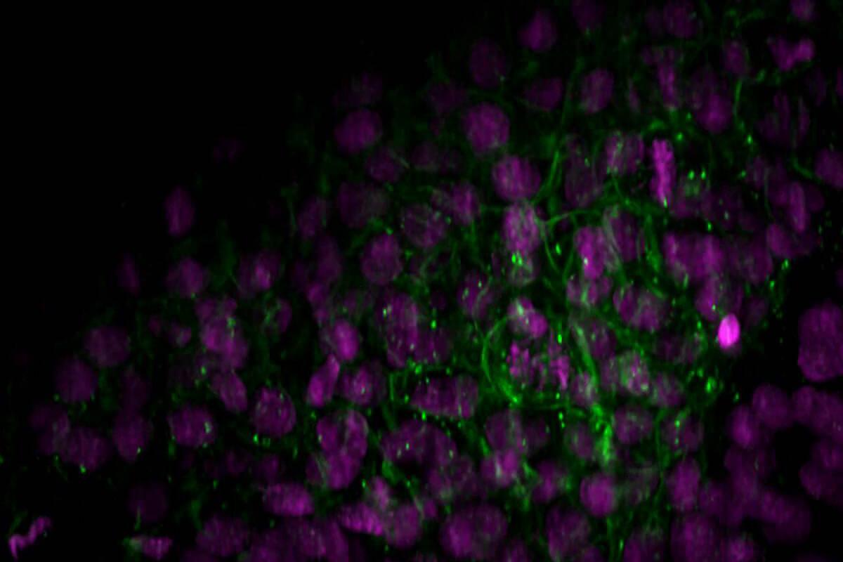 DeltaD-YFP transgenic zebrafish embryo (Liao et al. 2016, Nature Communications). Fusion protein driven by a transgene containing the endogenous regulatory regions, expression in the tailbud and pre-somitic mesoderm. Signal visible in the cell cortex, and in puncta corresponding to trafficking vesicles (green). Nuclei in magenta. The embryo was imaged for 5 minutes constantly; one volume (150 × 50 × 90 μm3) every 8 sec.
