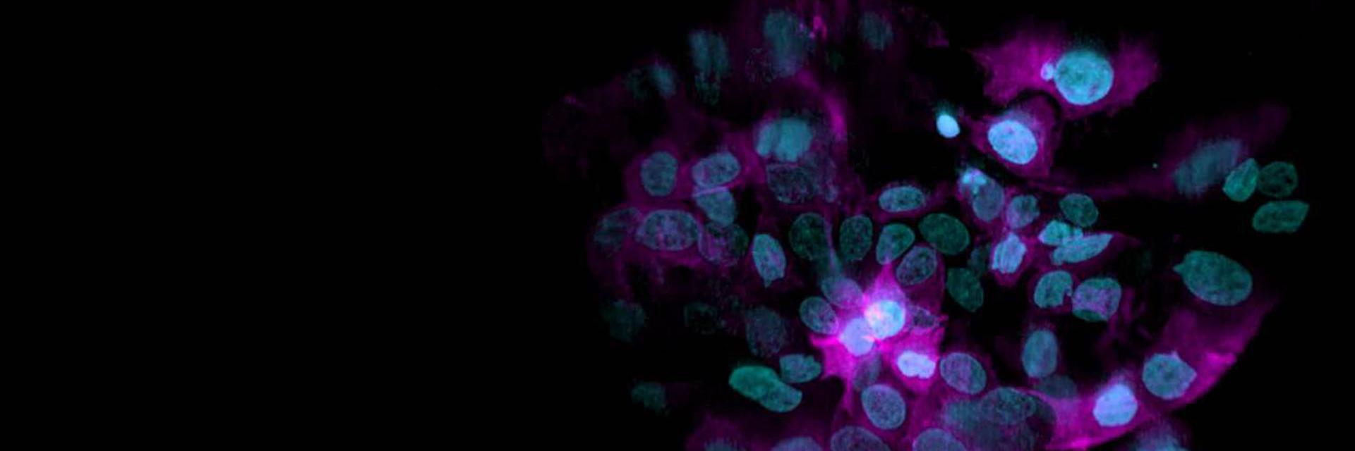 对细胞球进行三维渲染，该细胞球由表达H2B-mCherry（青色）和α-微管蛋白-mEGFP（品红色）的细胞组成。