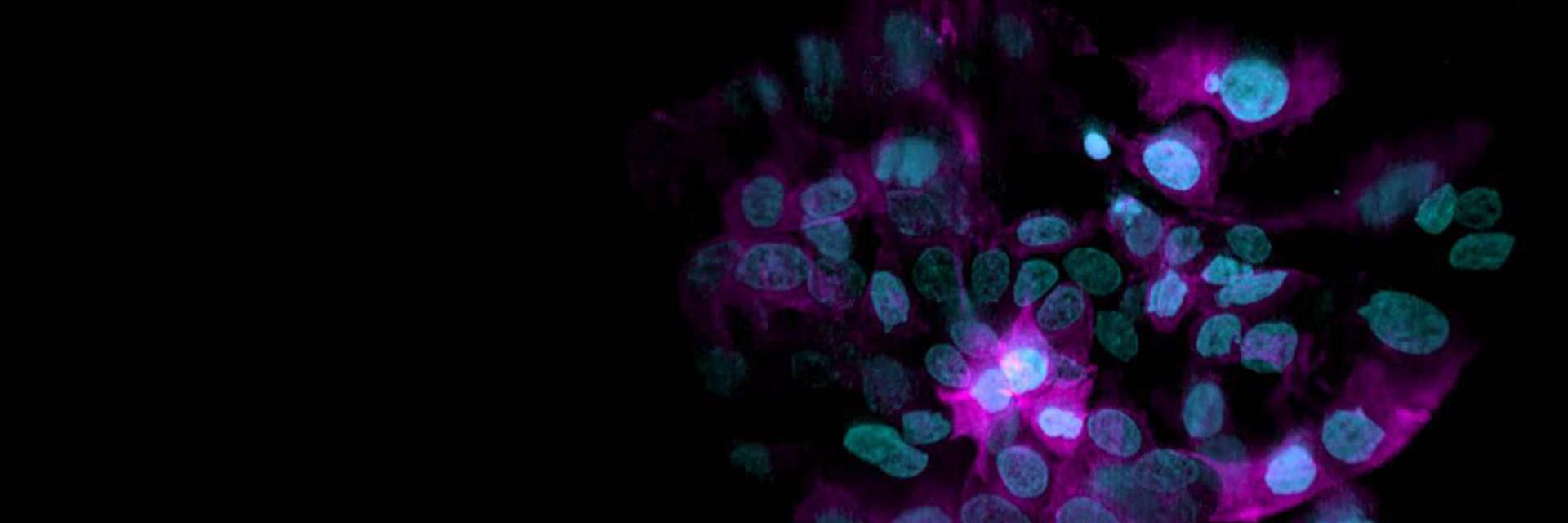 3D rendering of a spheroid consisting of cells expressing H2B-mCherry (cyan) and α-Tubulin-mEGFP (magenta).