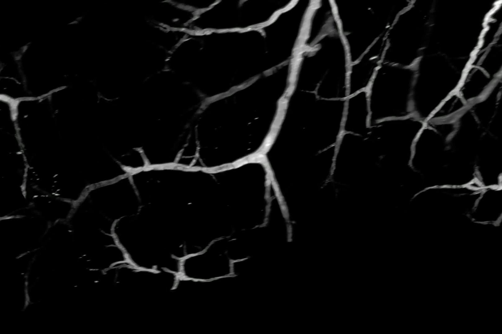 C57 BL6J mouse perfused with PBS, CellTracker™ CM-DiI Dye, and 4% PFA. Cleared using iDISCO+ protocol, final RIMS is Ethyl Cinnamate.