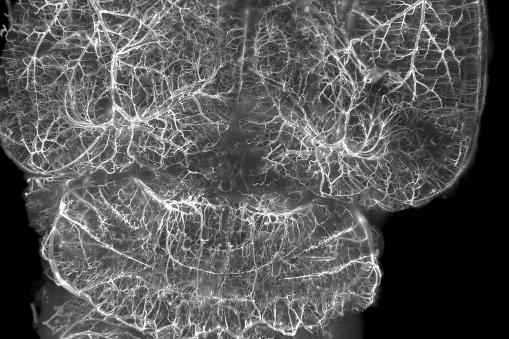 C57 BL6J mouse perfused with PBS, CellTracker™ CM-DiI Dye, and 4% PFA. Cleared using iDISCO+ protocol, final RIMS is Ethyl Cinnamate.