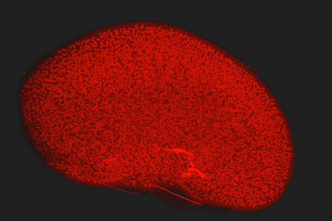 Rein de souris transparisé avec le protocole iDISCO et imagé dans du cinnamate d'éthyle avec les objectifs de détection Lightsheet 7, 5x/0,16 foc.