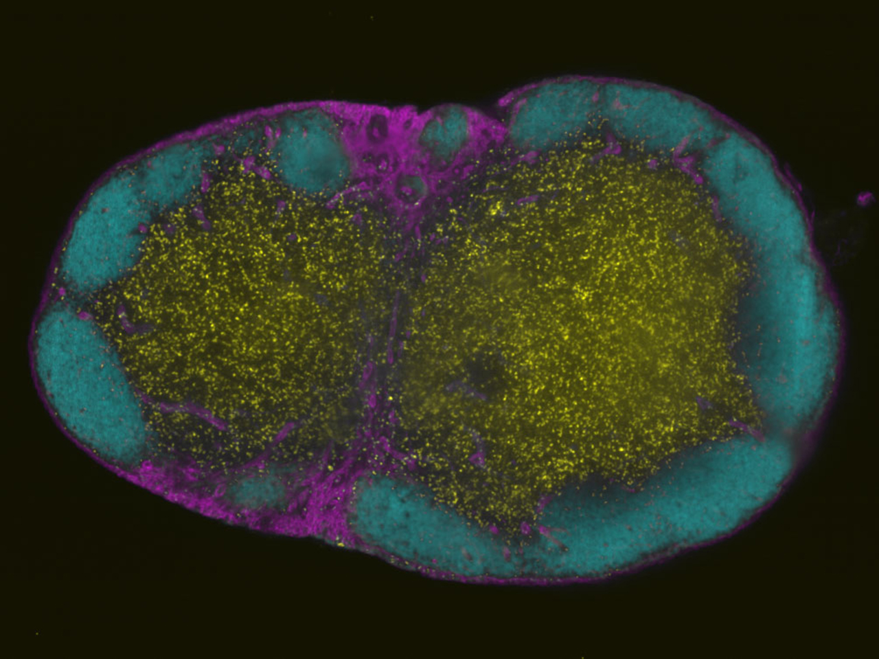 Cleared and imaged in Ce3D (Li et al. PNAS 163, 2017) at Refractive Index 1.49 (ph 7) with a ZEISS Lightsheet, 5x/0.16 objective (volume 2.5 x 2.5 x 1.6 mm)  The labels are yellow: GFP-CD8 T cells, cyan: B220 (B Cell Follicles, Alexa555), magenta: CD31 (Vasculature, Alexa647) Joanna Groom, The Walter and Eliza Hall Institute of Medical Research, Australia