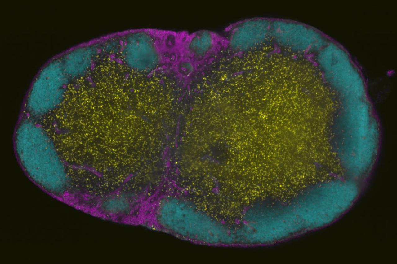 Cleared and imaged in Ce3D (Li et al. PNAS 163, 2017) at Refractive Index 1.49 (ph 7) with a ZEISS Lightsheet, 5x/0.16 objective (volume 2.5 x 2.5 x 1.6 mm)  The labels are yellow: GFP-CD8 T cells, cyan: B220 (B Cell Follicles, Alexa555), magenta: CD31 (Vasculature, Alexa647)