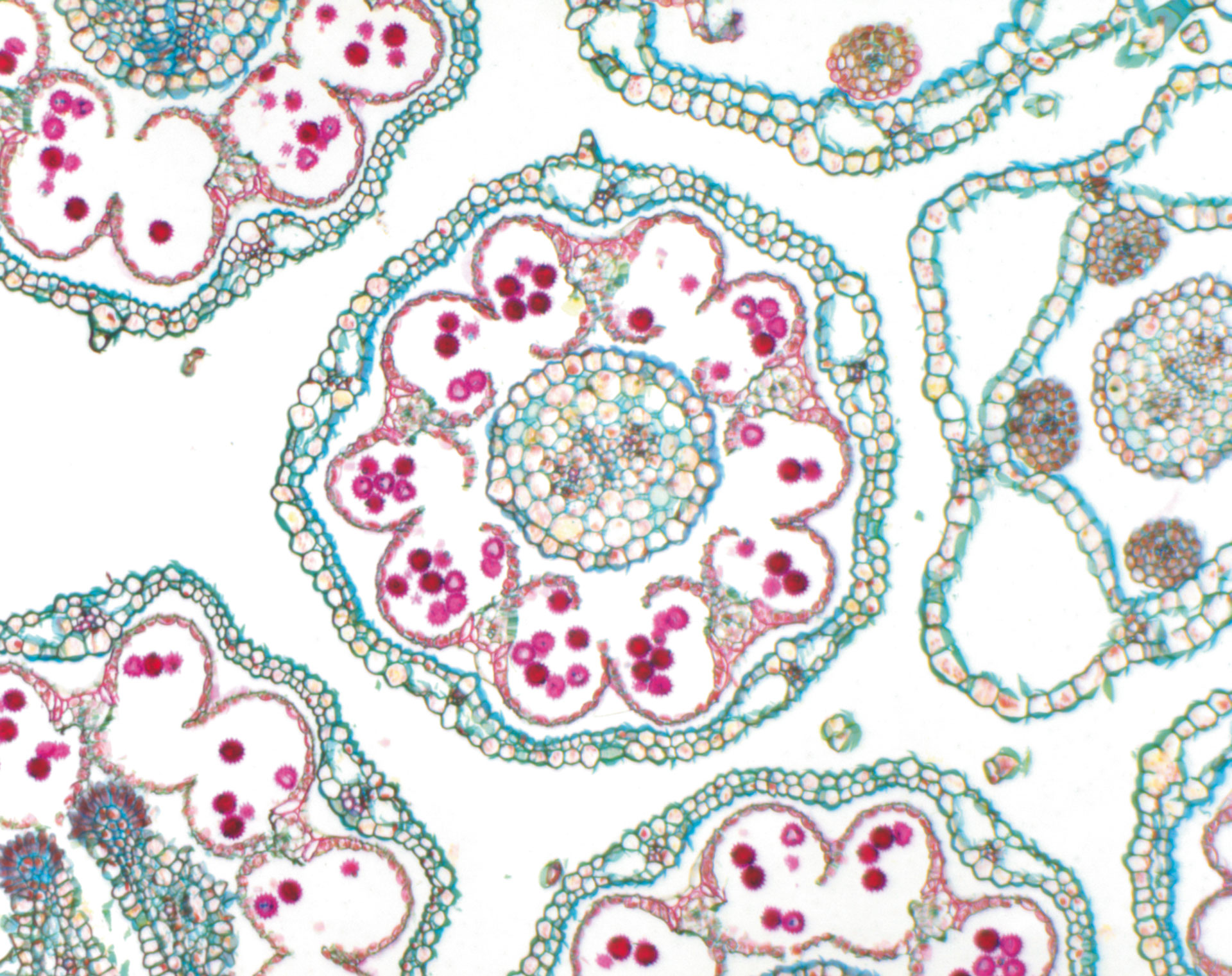 Campo claro para muestras transparentes, de alto contraste y teñidas para visualizar contornos y perfiles: Daisy, PlanApo S objetivo de 1,5x, aumento: 150×