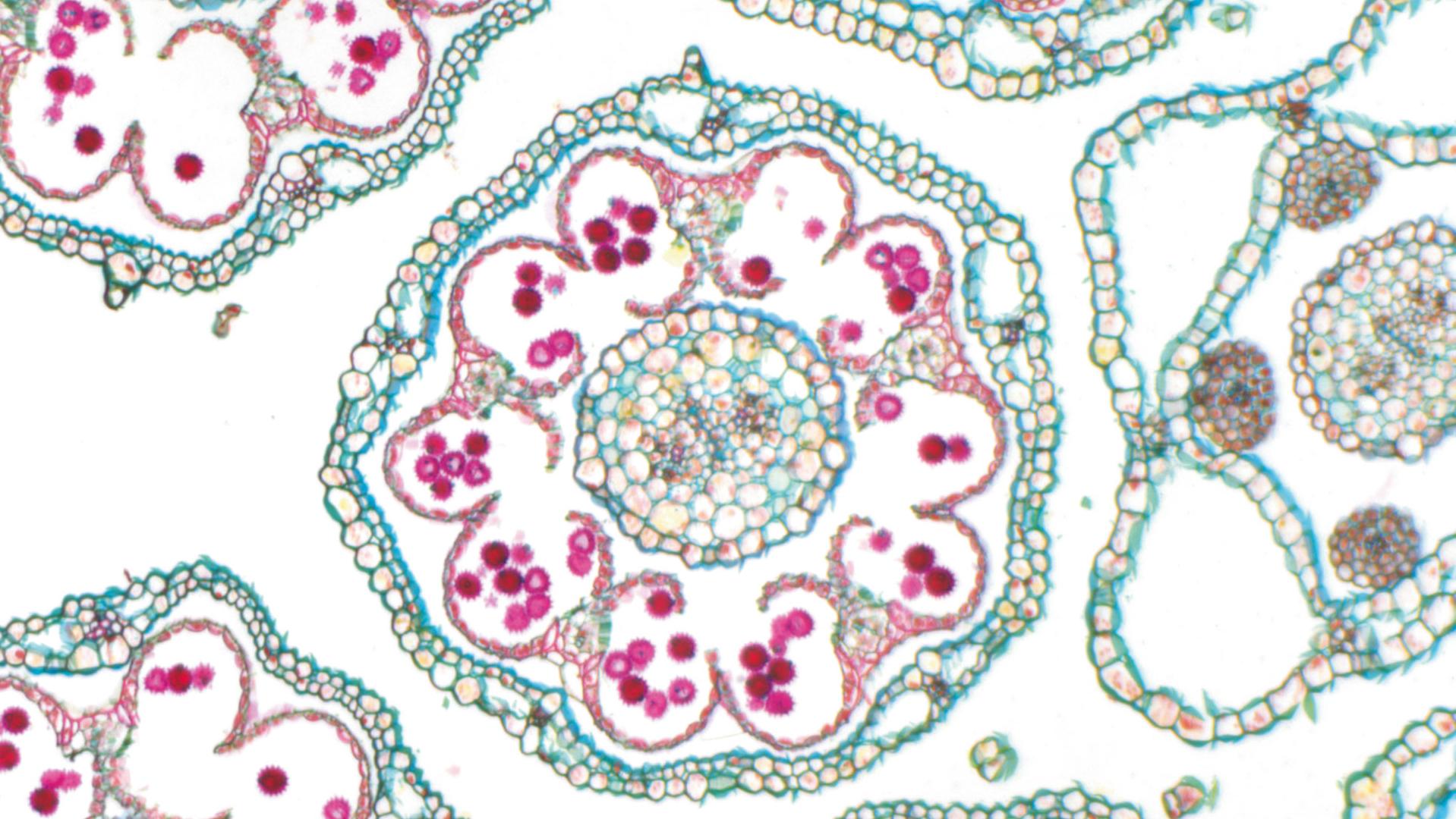 Brightfield for transparent, high-contrast and dyed specimens and to display contours and profiles: Daisy, PlanApo S 1.5x objective, Magnification: 150×