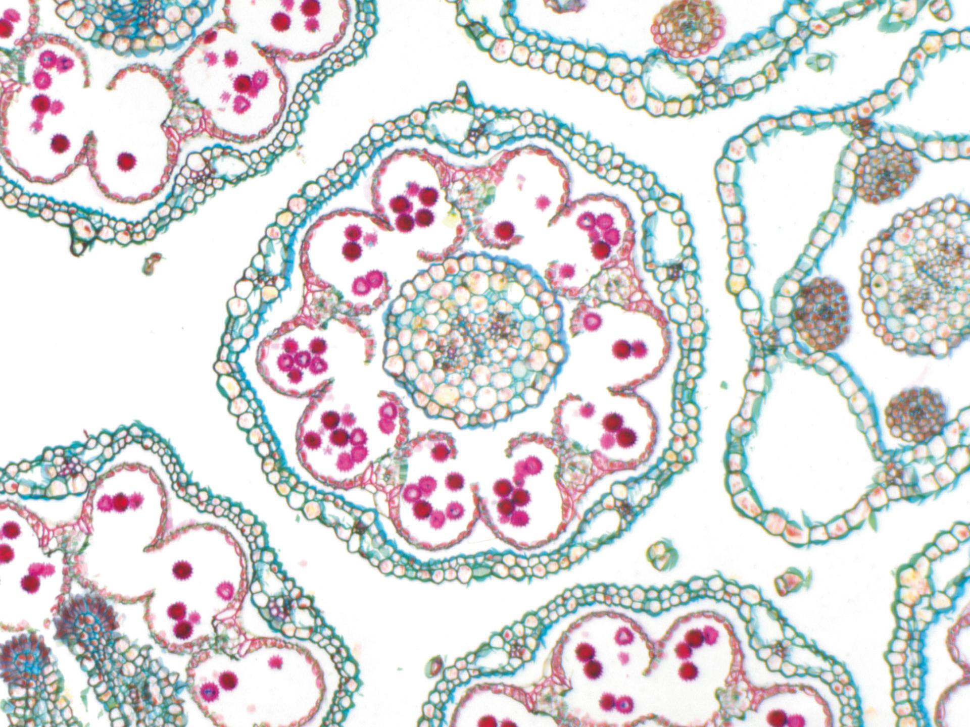 Brightfield for transparent, high-contrast and dyed specimens and to display contours and profiles: Daisy, PlanApo S 1.5x objective, Magnification: 150×