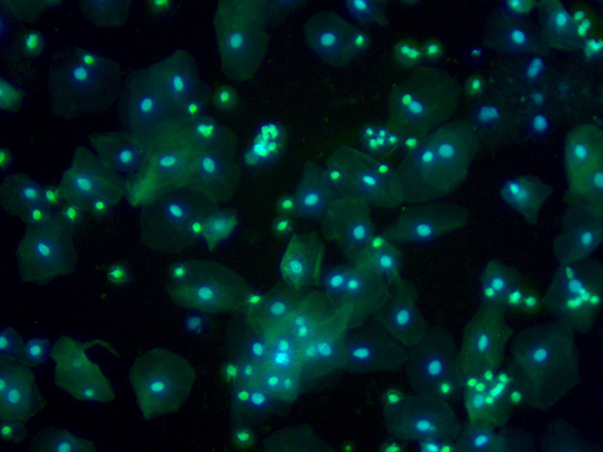 Human cells identified to be isolated and transported to the PCR tube