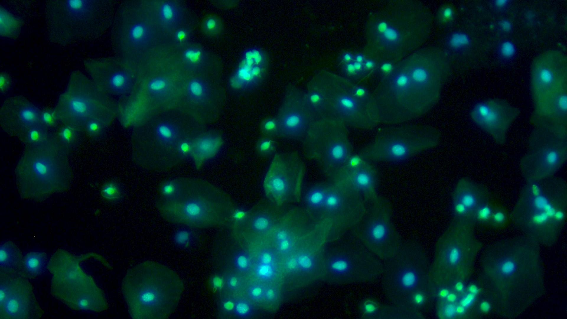 Human cells identified to be isolated and transported to the PCR tube