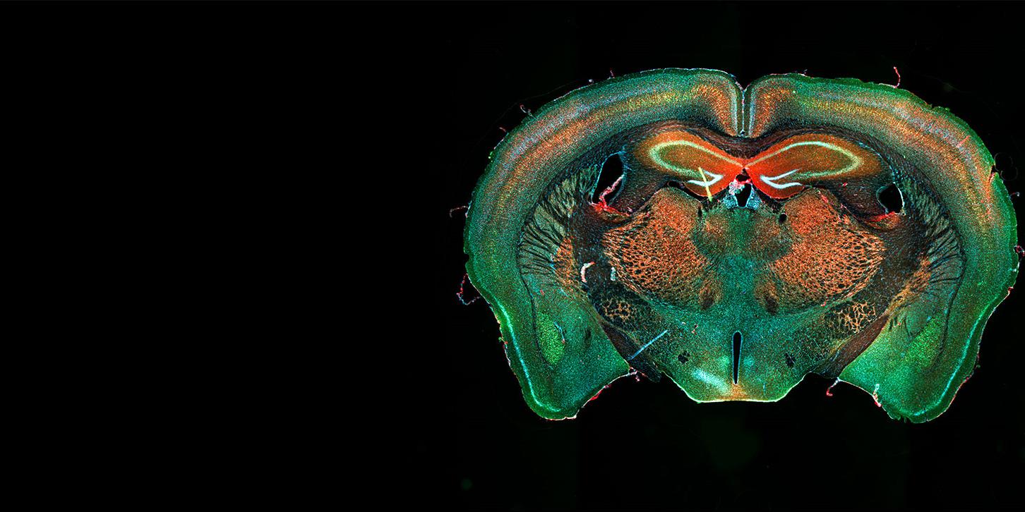 Mäusehirn, aufgenommen mit Axio Zoom.V16