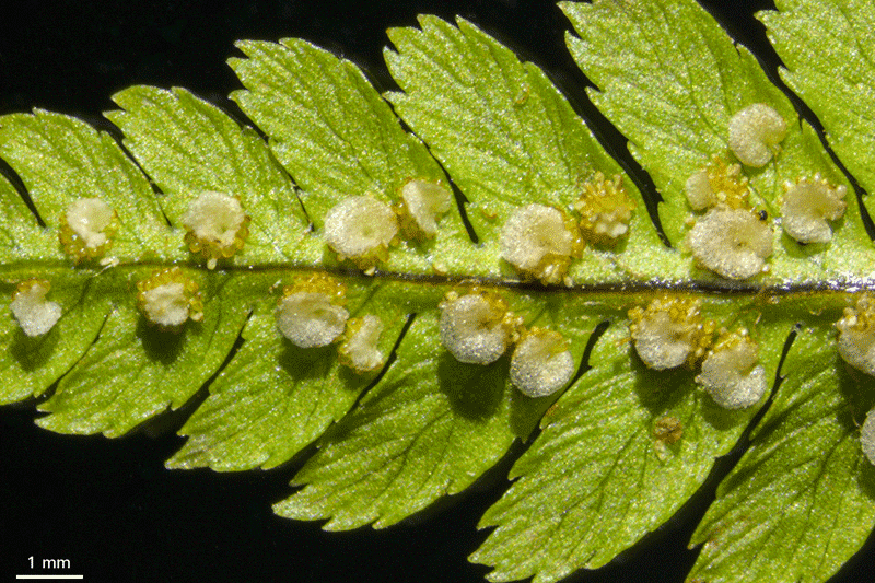 皇家蕨——孢子堆和孢子囊，使用反射光采集，暗场