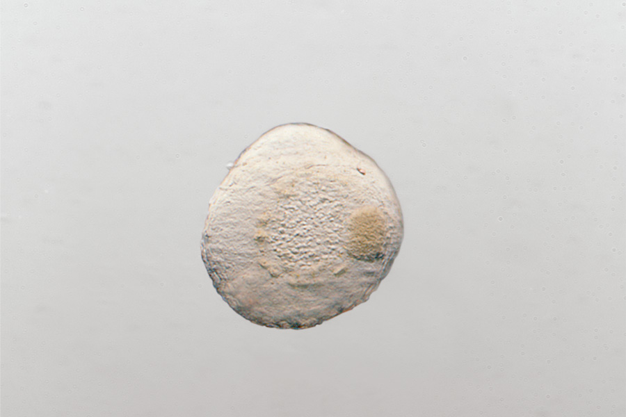 Embryo, Hellfeld, Schräglicht („negativer“ Reliefkontrast) 