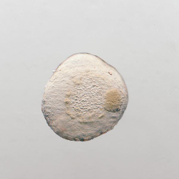 Embryon, champ clair, éclairage oblique (contraste en relief « négatif »)