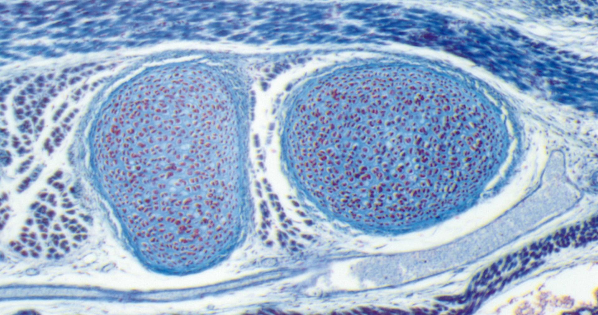 Maus-Embryo, eingefärbt, Durchlicht, Hellfeld, Vergrößerung: 94-fach 