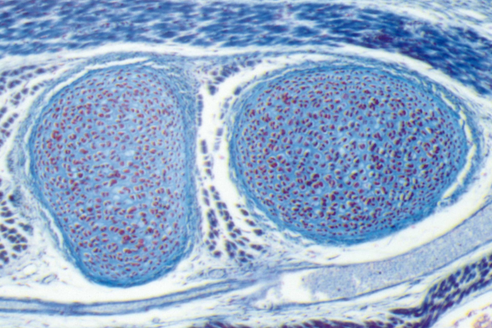 Maus-Embryo, eingefärbt, Durchlicht, Hellfeld, Vergrößerung: 94-fach