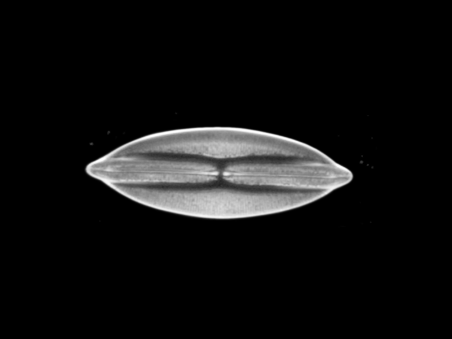 Diatomée, champ sombre en lumière transmise​