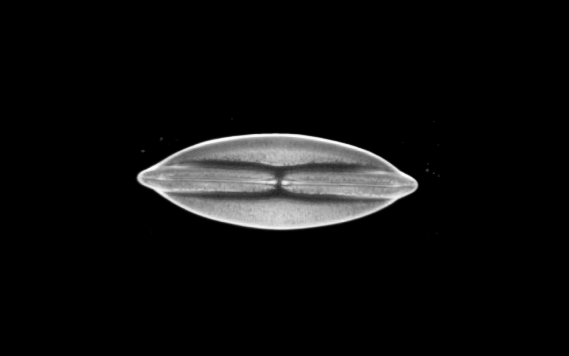 Diatomée, champ sombre en lumière transmise​ 