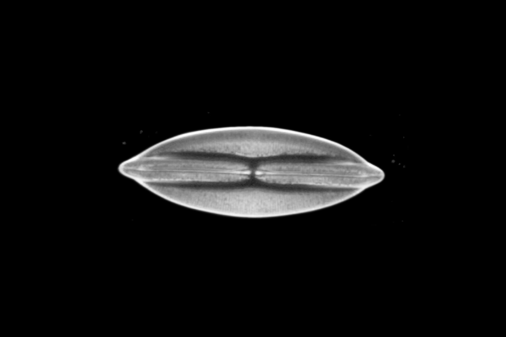 Diatom, transmitted light darkfield​