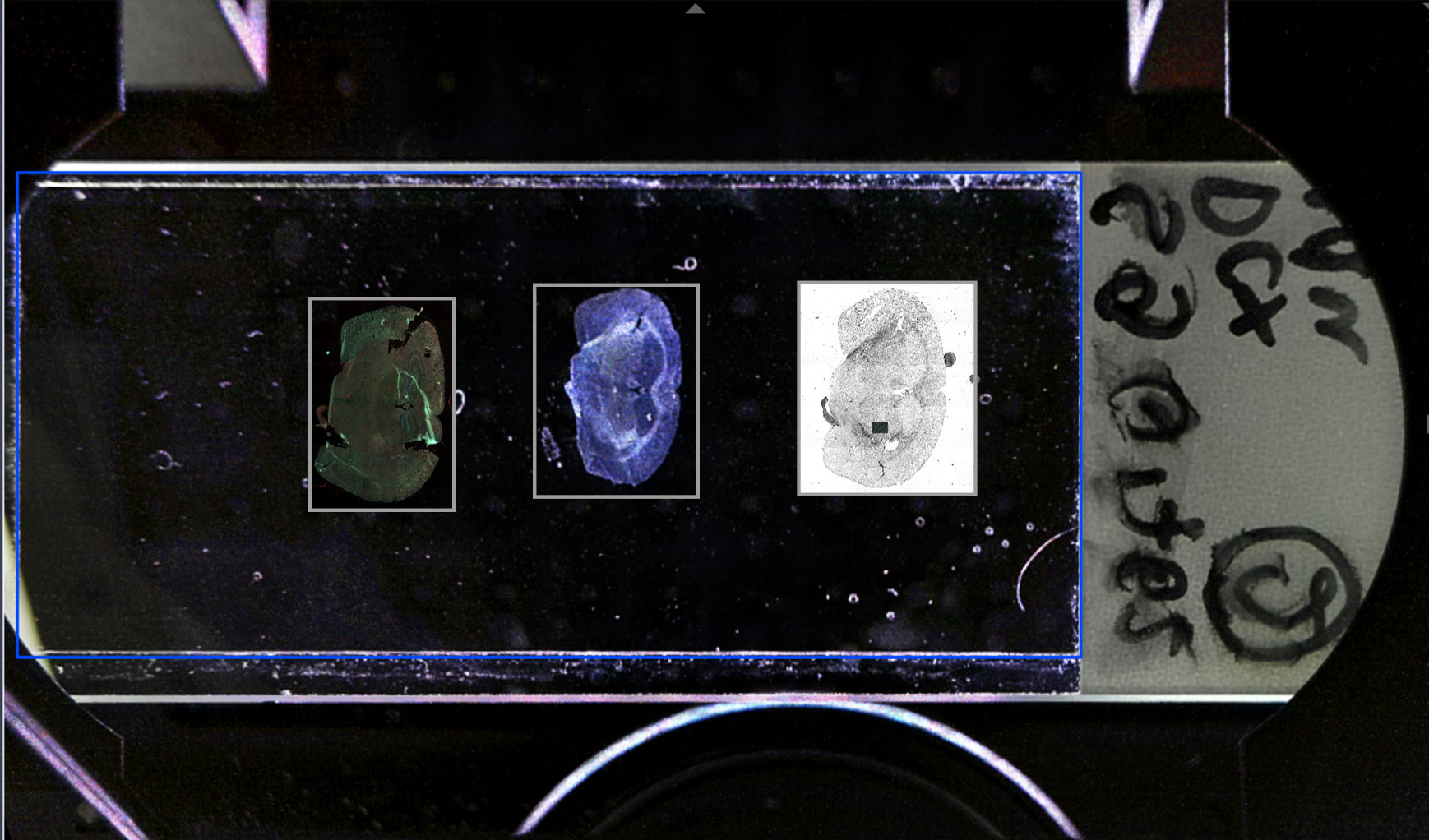 由AI Sample Finder提供的预览图，显示荧光、暗场复合衬度，以及荧光和相干衬度组合（从左到右）。样品由德国德累斯顿工业大学Carl Gustav Carus医学系解剖学研究所的M. Schmidt提供​ 样品由德国德累斯顿工业大学Carl Gustav Carus医学系解剖学研究所的M. Schmidt提供​