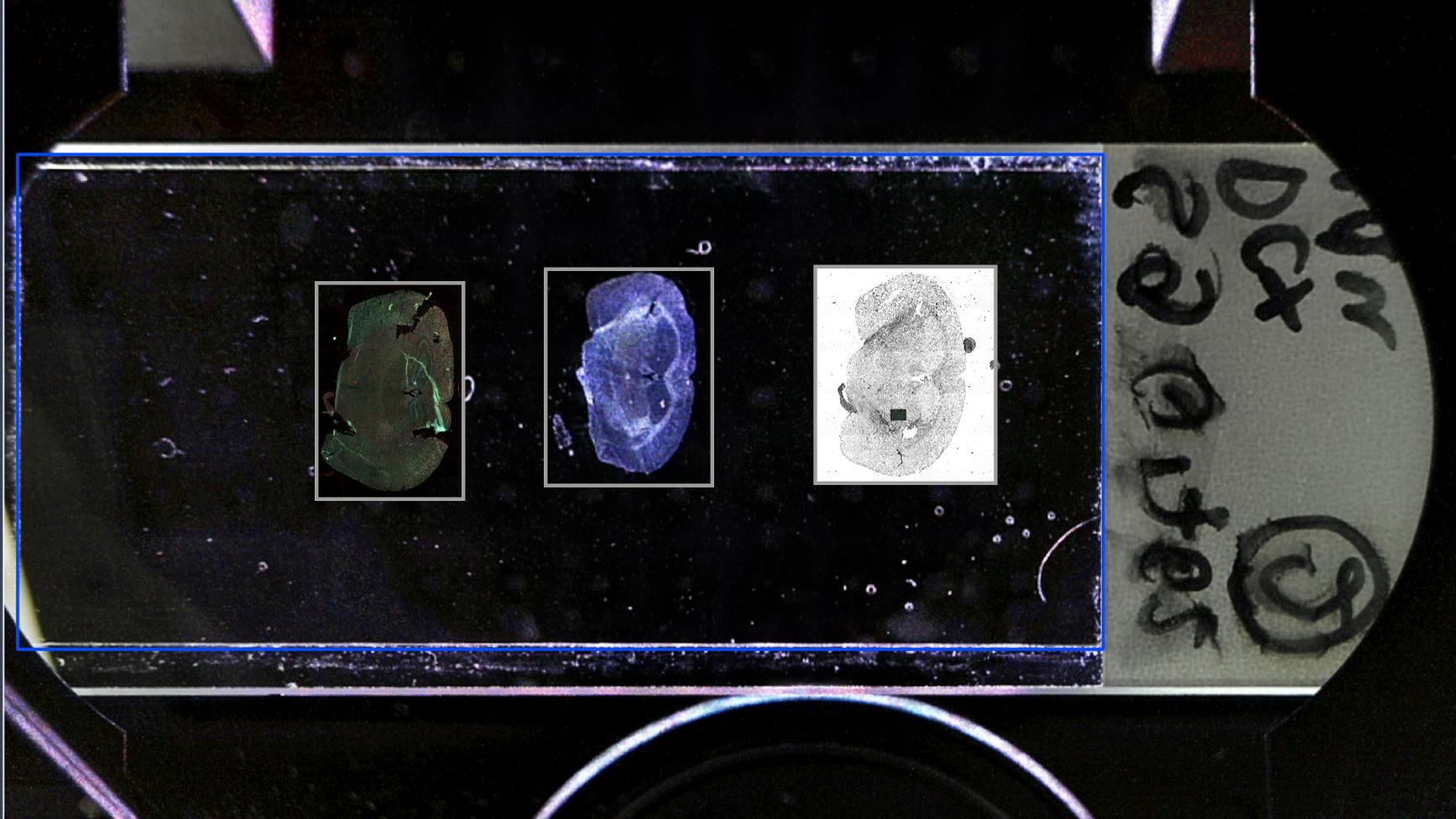 Image d'ensemble fournie par l'AI Sample Finder, montrant de gauche à droite la fluorescence, le contraste composite en champ sombre et une combinaison de fluorescence et de contraste de cohérence. Avec l'aimable autorisation de M. Schmidt, Institut d'anatomie, Faculté de médecine Carl Gustav Carus, Allemagne​