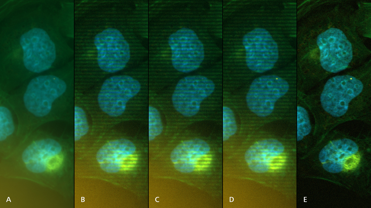 A: Weitfeldaufnahme. B–D: Unbearbeitete Originalbilder, die mit verschiedenen Gitterpositionen aufgenommen wurden. E: Ergebnisbild; die strukturierte Beleuchtung vermeidet effizient Licht aus nichtfokalen Ebenen. 