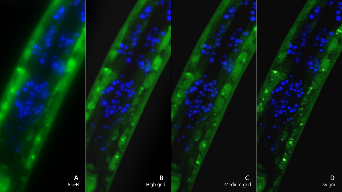 C. elegans, montage complet, vert : GFP, bleu : DAPI. Objectif : Plan-Apochromat 20 ×/0.8. Avec l'aimable autorisation du professeur Schnabel, T.U. Braunschweig, Allemagne.