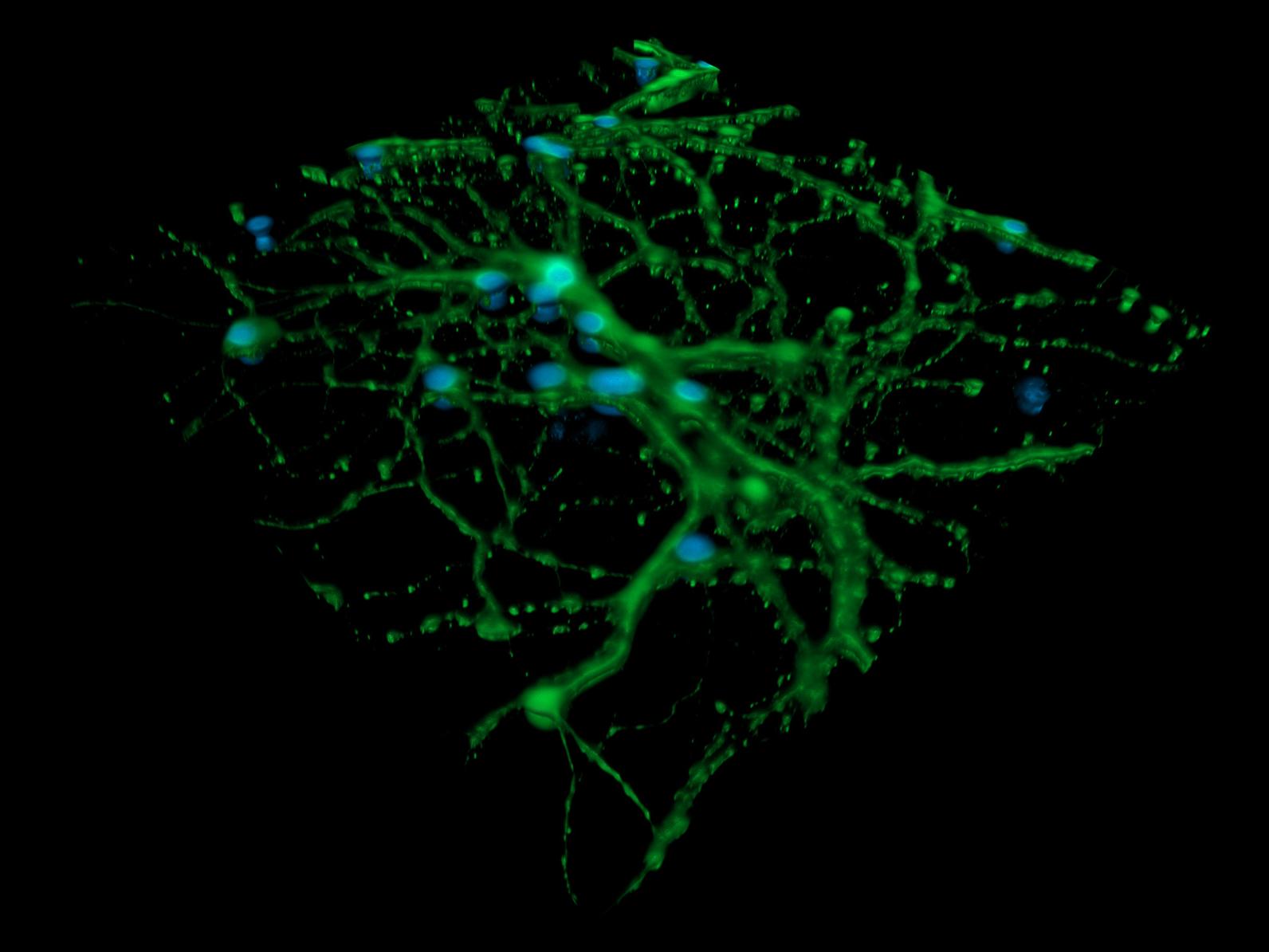 Vergleich von Weitfeldaufnahme und 3D-Rendering kortikaler Neuronen gefärbt auf DNS und Mikrotubuli. Mit freundlicher Genehmigung von L. Behrendt, Leibniz-Institut für Alternsforschung – Fritz-Lipmann-Institut e.V. (FLI), Deutschland.