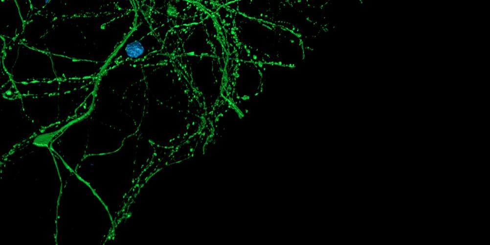DNAと微小管を染色した大脳皮質神経細胞の3D再構築。ご提供：L. Behrendt, Leibniz-Institute on Aging – Fritz-Lipmann-Institut e.V. (FLI), Germany