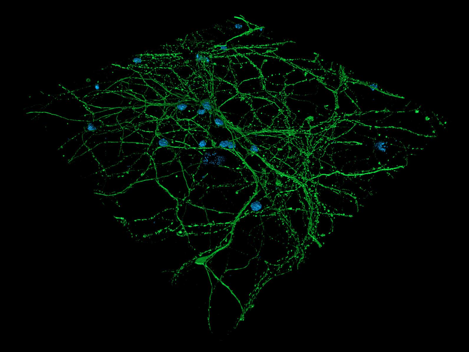 皮质神经元，DNA和微管染色的宽场图像和三维渲染对比。由德国莱布尼茨老龄化问题研究所——Fritz-Lipmann-Institut e.V.（FLI）的L. Behrendt提供。