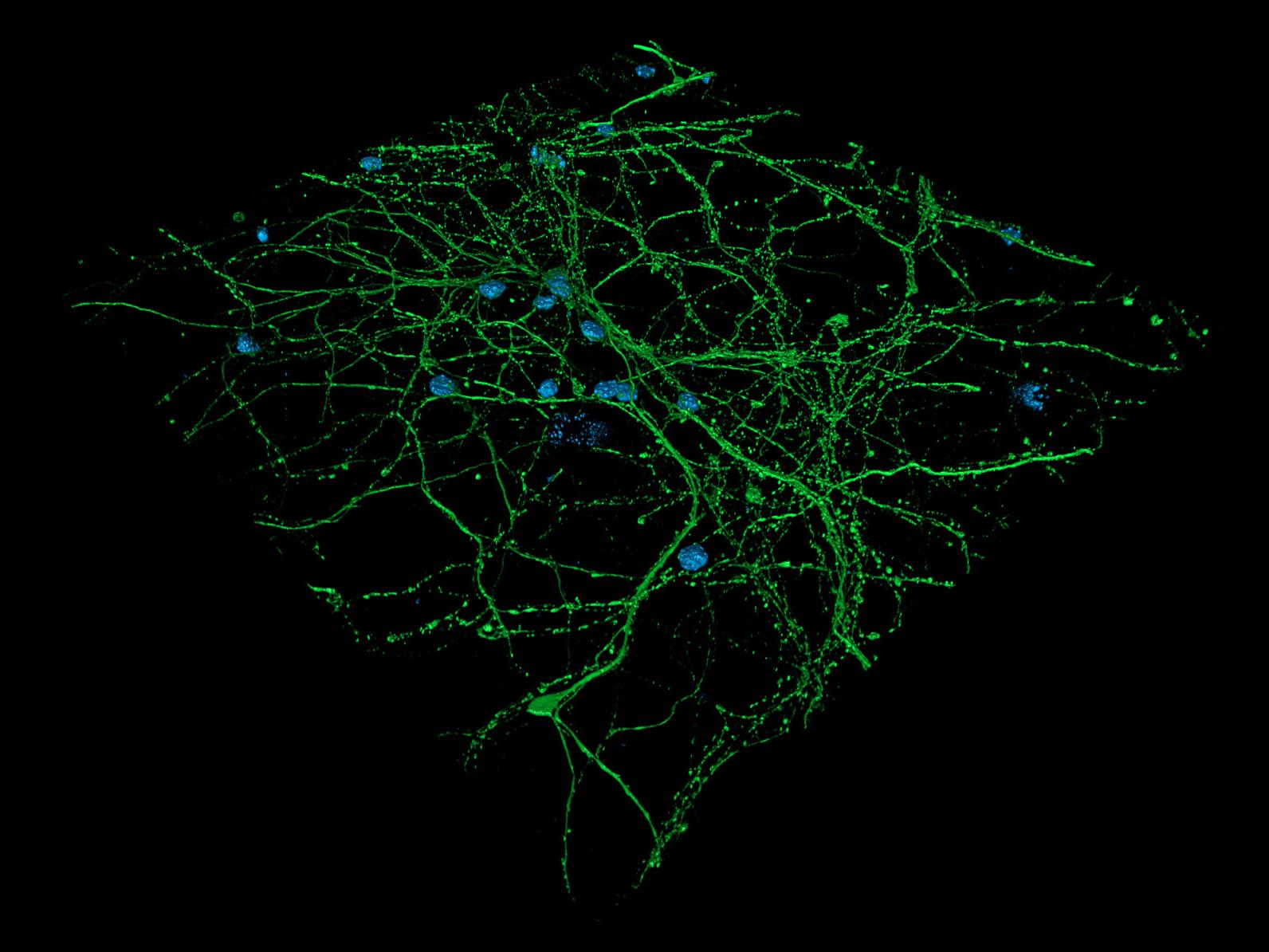 Vergleich von Weitfeldaufnahme und 3D-Rendering kortikaler Neuronen gefärbt auf DNS und Mikrotubuli. Mit freundlicher Genehmigung von L. Behrendt, Leibniz-Institut für Alternsforschung – Fritz-Lipmann-Institut e.V. (FLI), Deutschland.