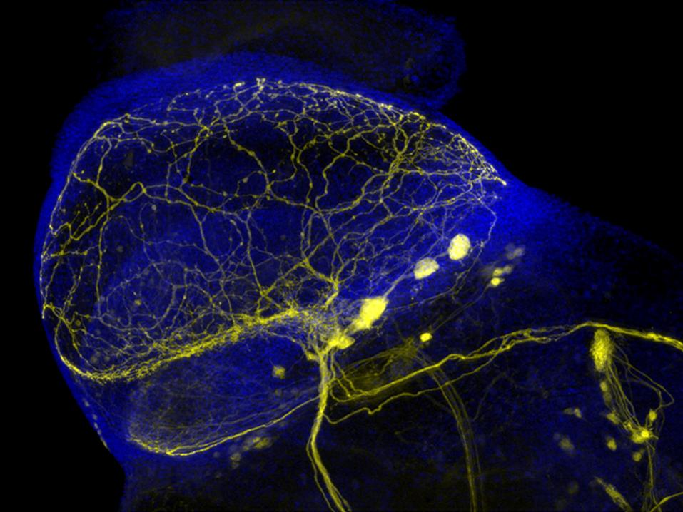 Apotome 3 - Neurones de drosophile, bleu : DAPI, jaune : GFP. Objectif : Plan-Apochromat 20×/0.8. Avec l'aimable autorisation de M. Koch, génétique moléculaire et du développement, Université de Louvain, Belgique.​