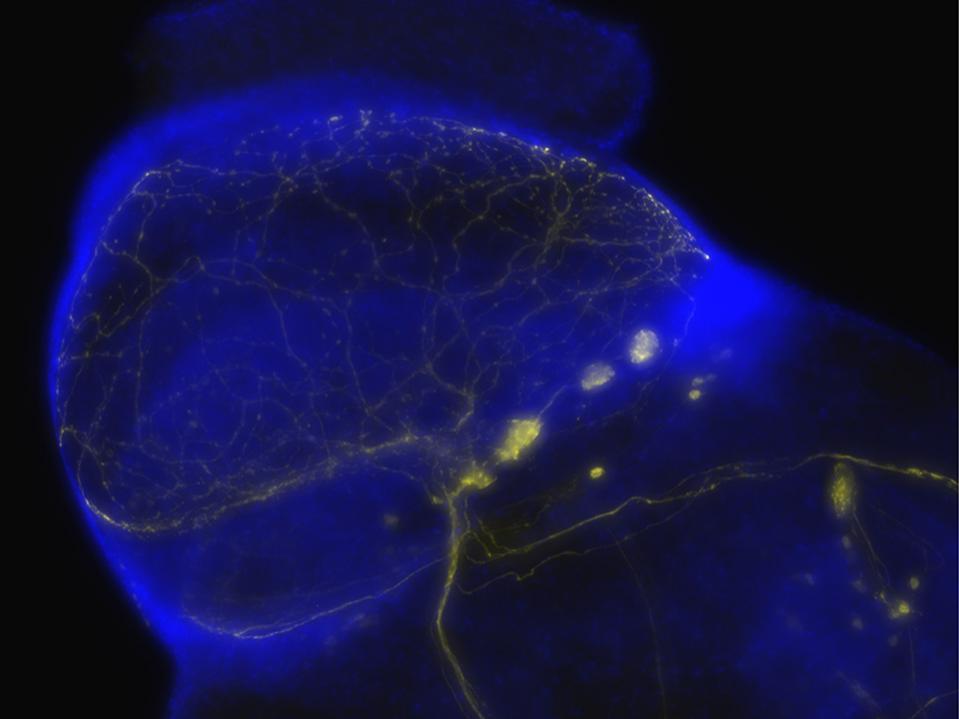 Konventionelle Fluoreszenz – Drosophila-Neuronen, blau: DAPI, gelb: GFP. Objektiv: Plan-Apochromat 20×/0,8. Mit freundlicher Genehmigung von M. Koch, Molekular- und Entwicklungsgenetik, Universität Leuven, Belgien.