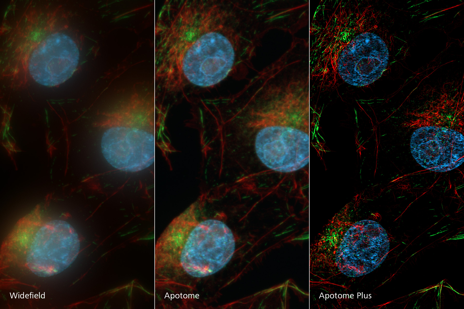 Bovine pulmonal arterial endothelial (BPAE) cells having nuclei stained with DAPI, F-actin with Alexa 488 phalloidin and mitochondria with MitoTracker Red CMXRos. Compared to the widefield image, Apotome removes out of focus light creating a crisp optical section. Apotome Plus further improves image quality and resolution resolving even finer structures.