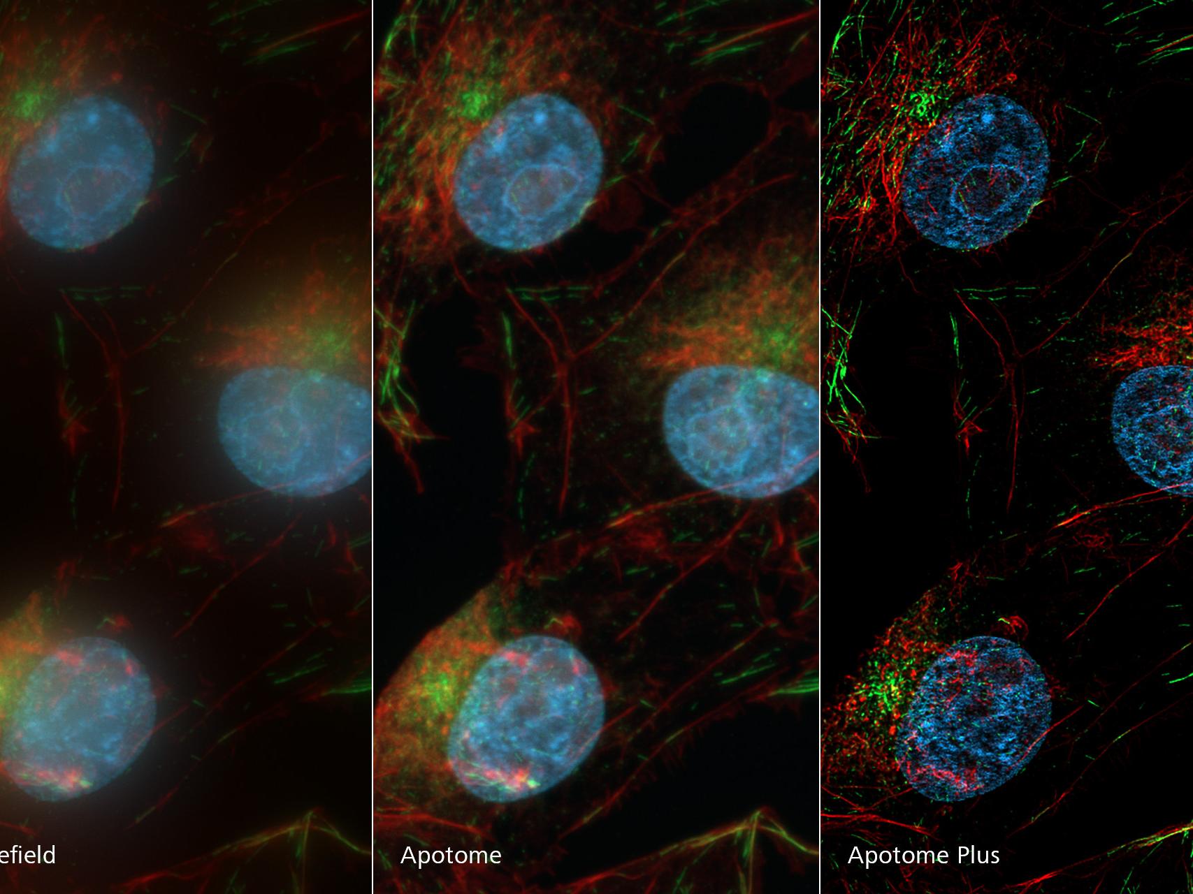Bovine pulmonal arterial endothelial (BPAE) cells having nuclei stained with DAPI, F-actin with Alexa 488 phalloidin and mitochondria with MitoTracker Red CMXRos. Compared to the widefield image, Apotome removes out of focus light creating a crisp optical section. Apotome Plus further improves image quality and resolution resolving even finer structures.