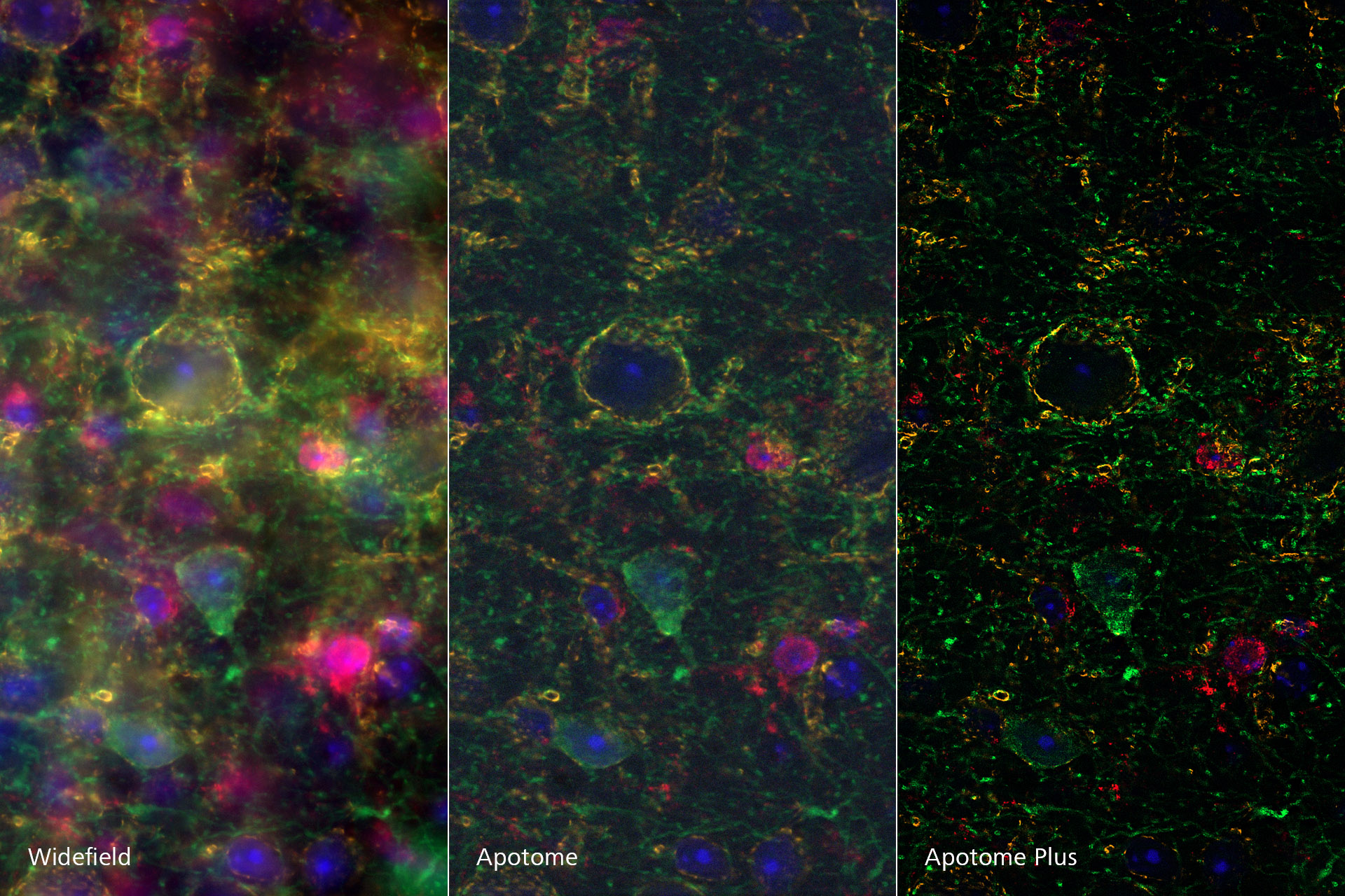 Sagittal section of adult mouse brain, imaged with ZEISS Axio Observer and ZEISS Apotome, processed with Apotome Plus.