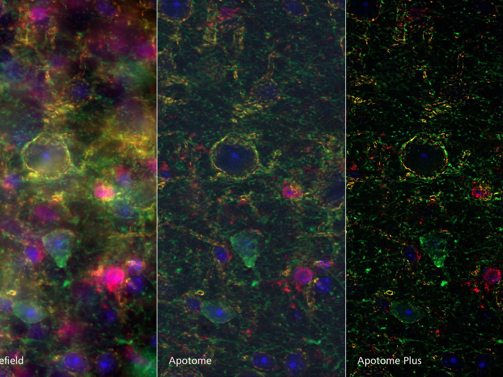Sagittal section of adult mouse brain, imaged with ZEISS Axio Observer and ZEISS Apotome, processed with Apotome Plus.