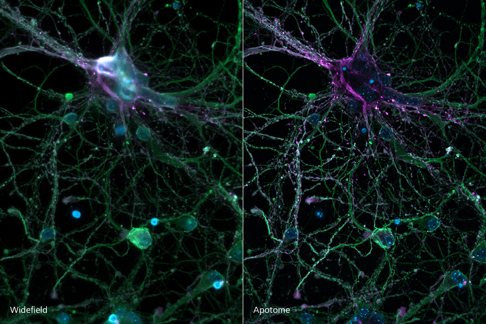 Cortical neurons stained for DNA, microtubules and microtubule-associated proteins.
